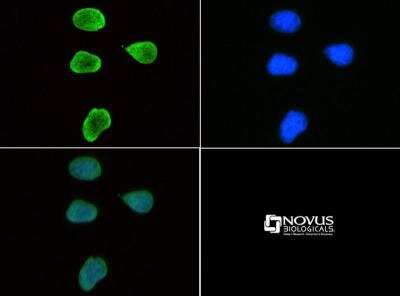 Immunocytochemistry/Immunofluorescence: Histone H3 [Trimethyl Lys9] Antibody [NB21-1073] - Immunofluorescence:  [NB21-1073] - Histone H3 K9me3 antibody was tested in HeLa cells with FITC (green). Nuclei were counterstained with DAPI(blue).